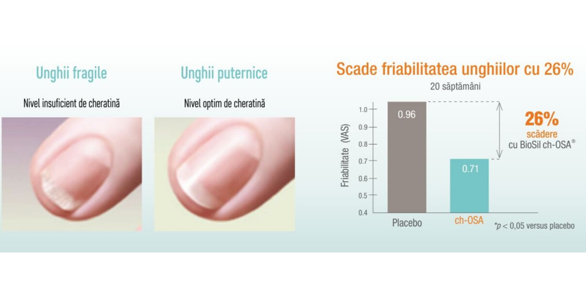 ioSil scade friabilitatea unghiilor pentru unghii puternice ioSil scade friabilitatea unghiilor pentru unghii puternice